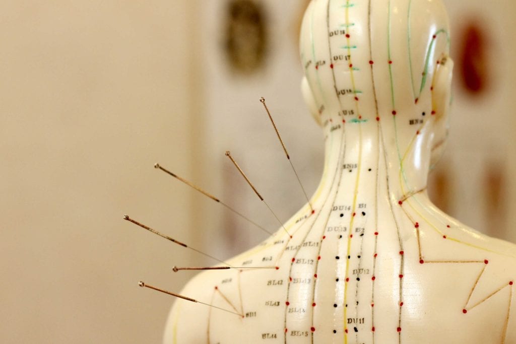 Acupuncture Points